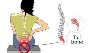 Best Treatment for tailbone pain in Jaipur