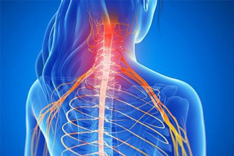 Top neck pain doctor in Jaipur