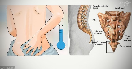 Treatment For Tailbone Pain In Jaipur - Dr. Gaurav Sharma