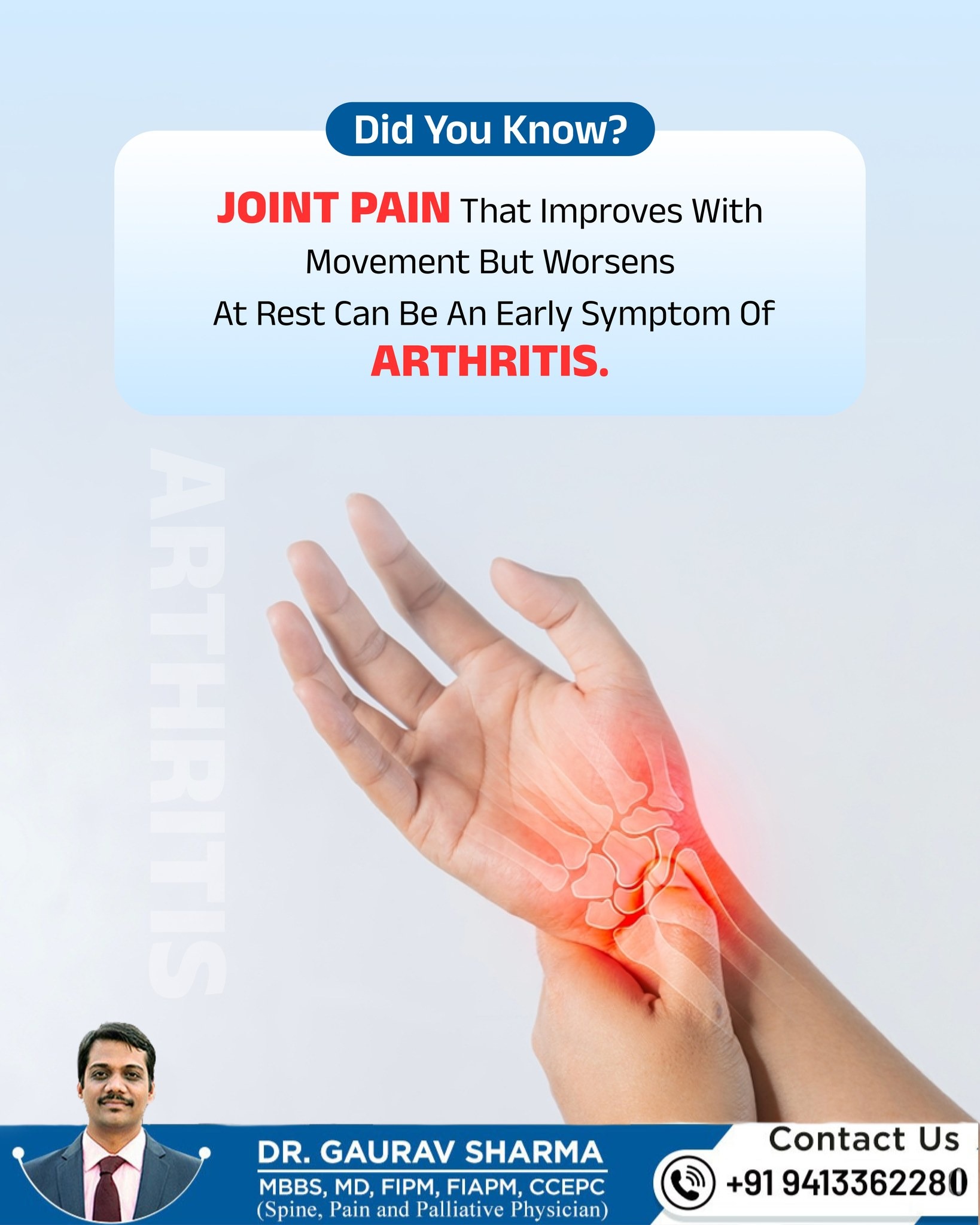 Early Sign of Arthritis